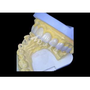 Zirconia Dental Crown Delivering Unbeatable Strength And Natural Smoothness,And