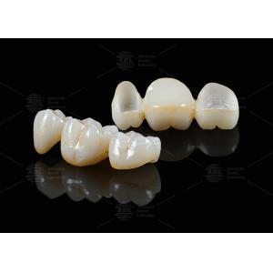 Translucency White Full Contour Zirconia Crown FCZ Monolithic Zirconia Crown