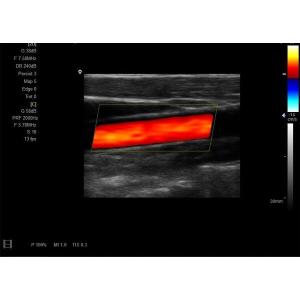 Ultrasound Imaging Machine Portable Ultrasound Scanner with 160G Capacity