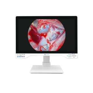 4K All In One Endoscope Camera System Built-in LED Light With 32 Inch Medical