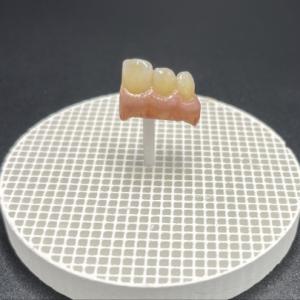 Mixable Shade System Paste Cervical / Incisal Zone Formulas For PFM & Glass