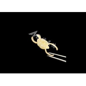 Zirconia Crown with HPP Bonded Bridge for Enhanced Smile Aesthetics and