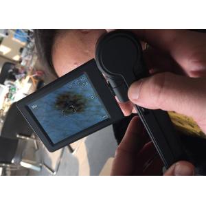 Video Dermatoscope Microscope Digital Skin Analyzer USB Skin Surface Checker