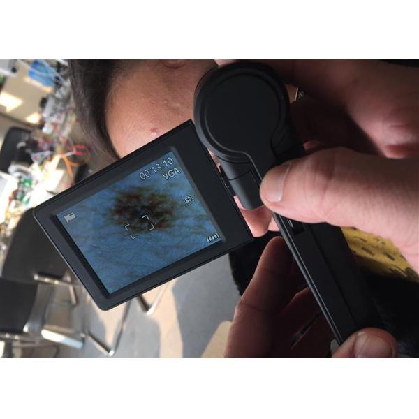 Quality Video Dermatoscope Microscope Digital Skin Analyzer USB Skin Surface Checker With 3 Inch Monitor wholesale