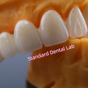 CAD CAM Mill Zirconia Crown Bridge Highly Biocompatible
