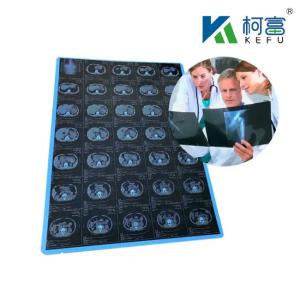 China 125 Micron Semi - Transparent White Laser Medical X - Ray PET Plastic Films  Engineered To Excel In Medical on sale