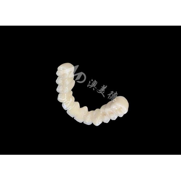 Long-lasting Bonding PFM Dental Crown Bridge With Excellent Biocompatibility