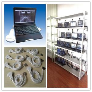 USB Color Handheld Ultrasound Scanner , Portable Ultrasound Device Lightweight