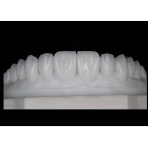 Translucency Natural Esthetic Zirconia Crowns Excellent Biocompatibility And