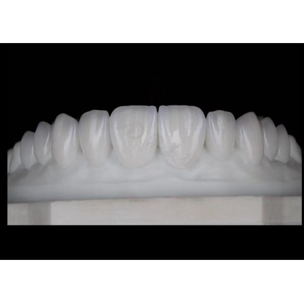 Quality Translucency Natural Esthetic Zirconia Crowns Excellent Biocompatibility And Strength wholesale