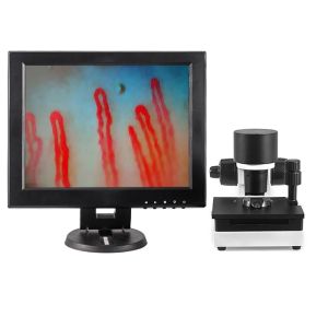 Blood Capillary Microcirculation Microscope 600X Magnification DC12V 2A Output