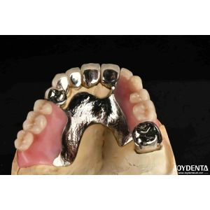 Elaborate Framework Final Set Stable Dental Structure Designed Teeth Finish