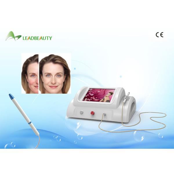 Quality High frequency no rissk 30MHz RBS device portable spider vein removal machine for sale wholesale