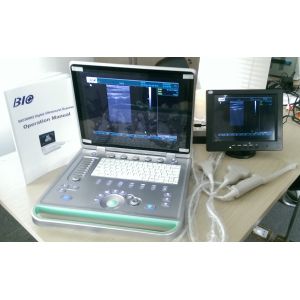 3D Digital Laptop Portable Ultrasound Scanner With All Kinds of Probe