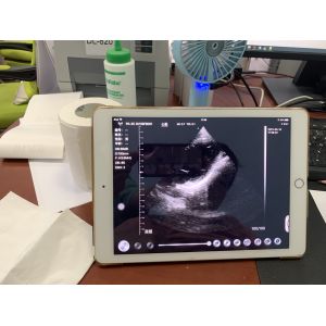 Wireless Phased Array Ultrasound Transducer Handheld Cardiac Echography Wireless