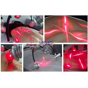 Low Level Physical Therapy Laser Machine Pain Relief Class Iv Cold Laser Device