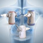 Nebulization Rate 0.25-0.6 Ml/min Child Nebulizer Beyond Compressor Nebulizer