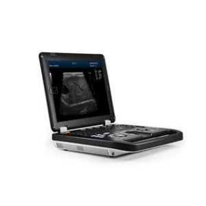 Portable Color Doppler Portable Ultrasound Scanner with Detectable depth of 2