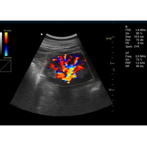 15”LED Portable Color Doppler Machine Digital Color Ultrasonic Diagnostic System