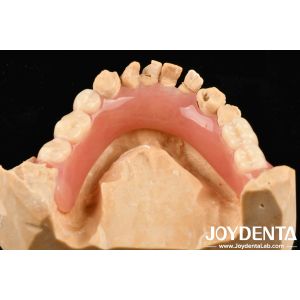 Personalized Customization Acrylic Denture Finish Good Elasticity And Lightweigh