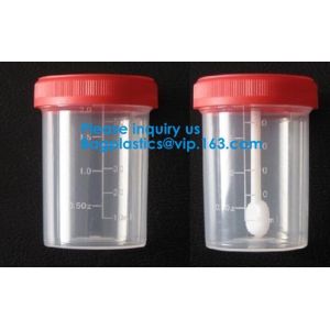 Sterile Disposable Hospital Sample 60ml 100 120 Ml Test Measurement Collection