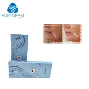 24mg Crosslinked HA For Lips Nose And Cheek