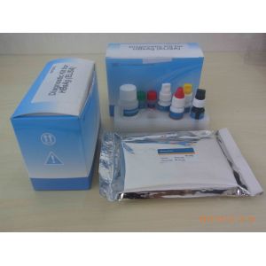 Cheap Ce Approved Hbsag Elisa Kit Medical Diagnostic Device for sale