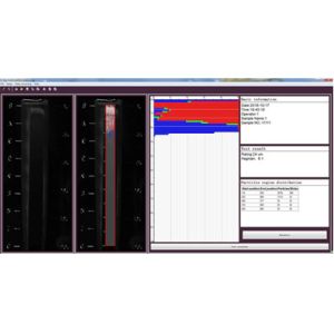 0-200μM Automated Particle Analyzer In Good Reproducibility And Accuracy For