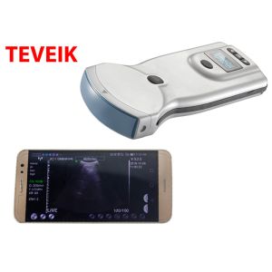 Low Price Wireless Ultrasound Probe Mobile Gyne Ultrasound Machine