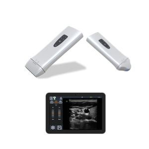 Palm Portable Color Doppler Probe Handheld Ultrasound Scanner With 220g Weight
