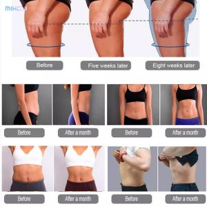 Electrical Muscle Sculpting Machine peface Neo RF Operation With 2 Handles