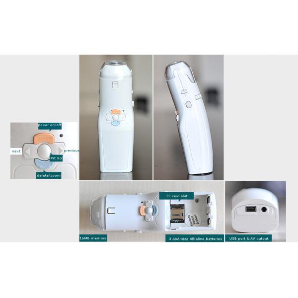 High Definition Echo - Digital Electronic Colposcope Gynaecologic Apparatus