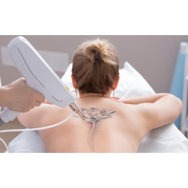 Portable Q Switched Nd Yag Laser Pigment Removal Machine For Clinic And Hospital