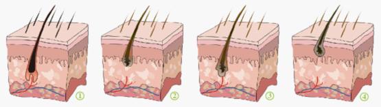 SHR Handpieces IPL Hair Removal Machines / Skin Rejuvenation Machine