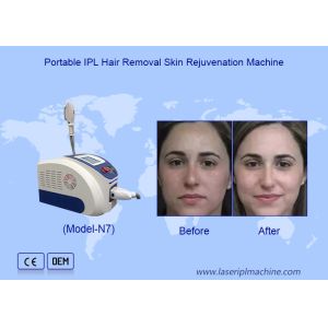 Advanced IPL Laser Hair Removal And Skin Rejuvenation With Imported Sapphire