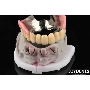 China Advanced Dental Metallic Material For Supporting Mastication Needs on sale