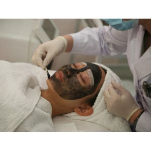 Cheap cheap portable mini tatoo remvoal facial rejuvenation beauty machine ND Yag Q-switch laser for sale