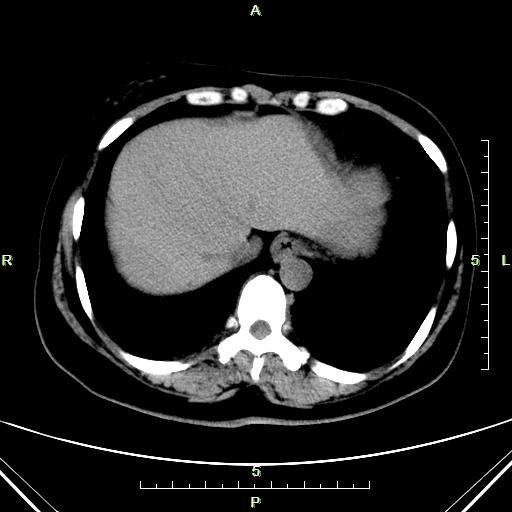 Quality Thin Konida X Ray Diagnostic Imaging Laser Blue Paper For Xray Machine wholesale
