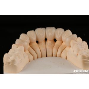 High Translucency Layered Zirconia Crowns Bridges Dental Restorations lifelike