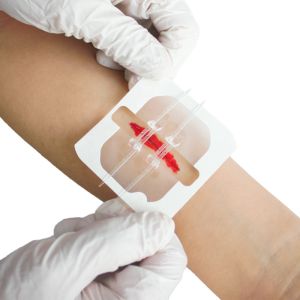 PWF1001 Flexible Fabric Bandages Wound Closure Device 2PCS