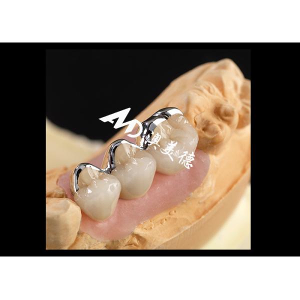 Quality Strong PFM Porcelain Fused To Metal Crown Excellent Biocompatibility Wear Resistance wholesale