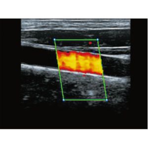 Diagnostic Handheld Ultrasound Scanner Equipment Wireless With 8 TGC Adjustments