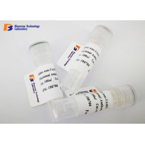 China Mouse Anti ENO2 Custom Monoclonal Antibody with NSE Fusion Protein on sale