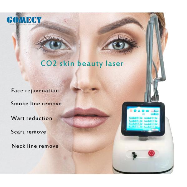 GOMECY Fractional CO2 Laser Skin Resurfacing Warts Scars Removing Vaginal Rejuvenation
