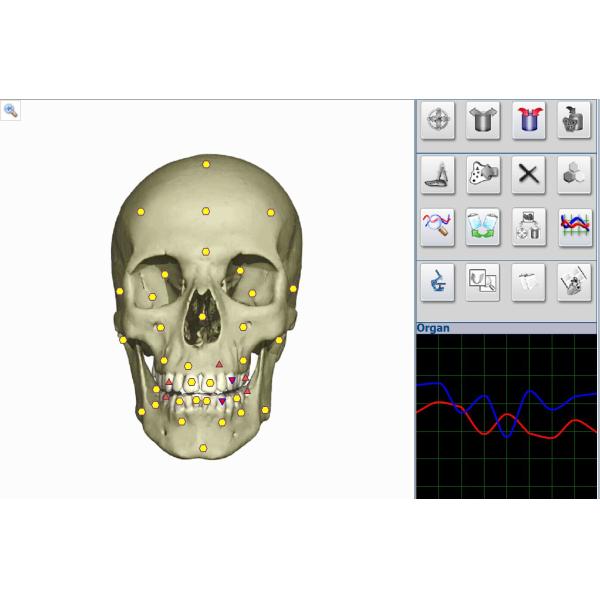 Newest Metatron Hunter NLS System 4025 Bioresonance Health Scan and Therapy