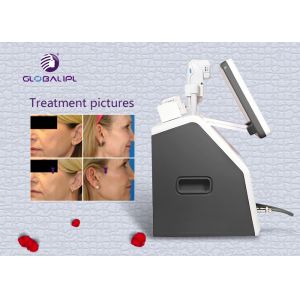 Salon HIFU Machine Wrinkle Removal Skin Rejuvenation Body Slimming Machine