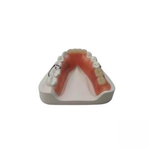 Cheap Flexible Resin Denture Dental Lab Dental Acrylic Removable Partial Dentures for sale