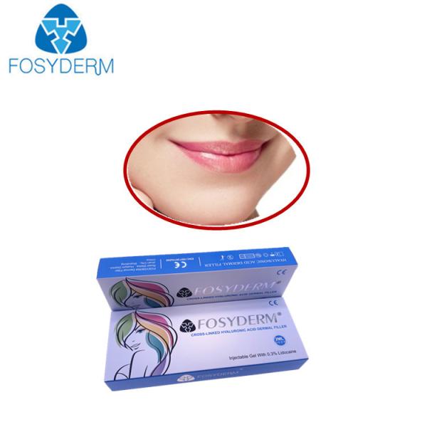 Smile Lines Hyaluronic Acid Dermal Filler Volume Derm Line Lyft Lidocaine Dermal