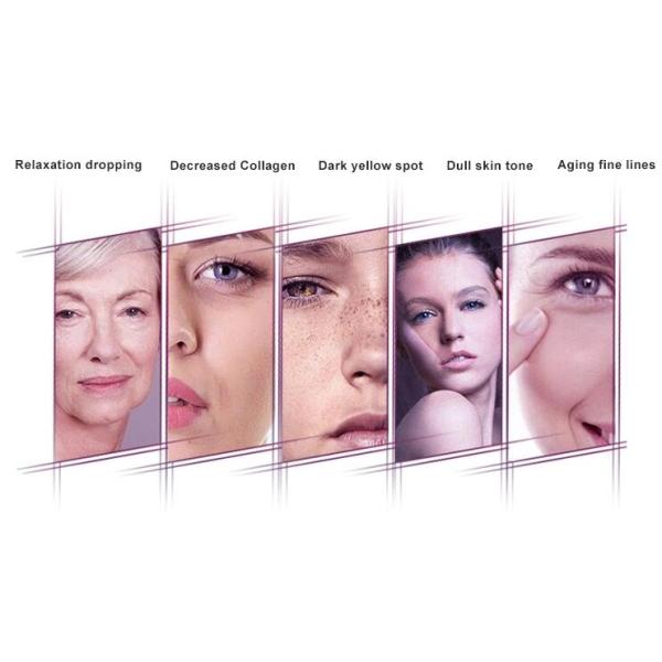 5 In 1 RF Skin Tighten 5V Radio Frequency Facial Machine