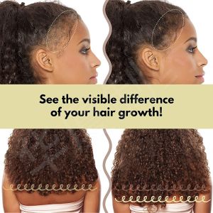 Natural Hair Growth Conditioner DIY Kit With Continuous Spray Bottle Package